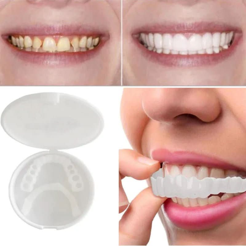 SnapFit Smile - tooth restoration for a perfect smile without a visit to the dentist