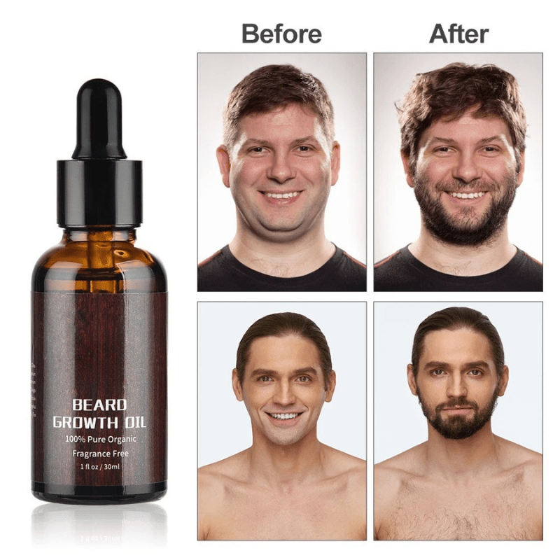 Bartboost - Beard growth kit for a healthy & strong beard