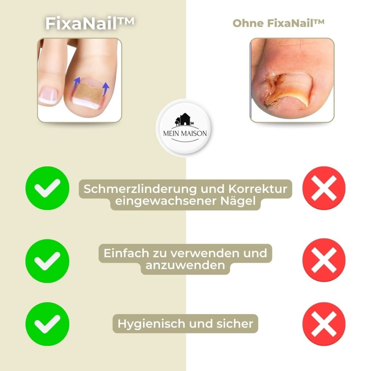 FixaNail - Gentle nail correction against ingrown nails & pain