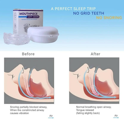 SnoreFree PRO - Anti-snoring mouthpiece against sleep apnoea & snoring