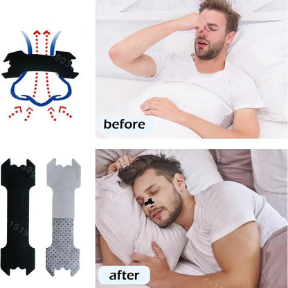 AIRWAYCARE – Anti-Snoring Nasal Strips for Free Breathing & Better Sleep