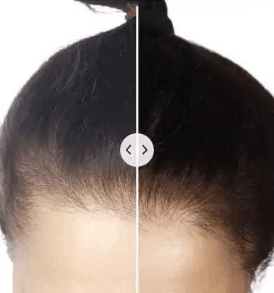 ChicBlend - 5-in-1 hair comb with massage & light therapy for healthier hair