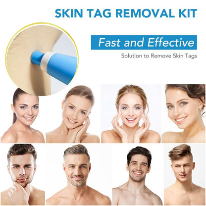SpotOff Skin Tag Remover - Painless skin tag removal for neck, back & body