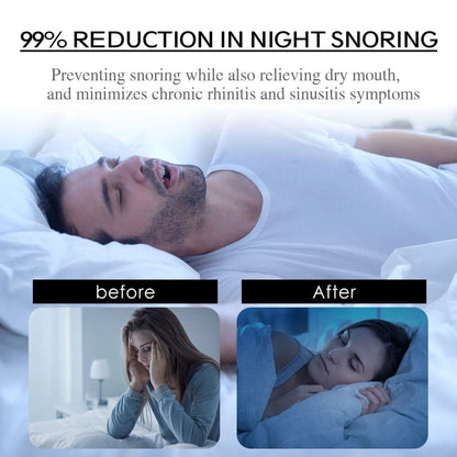 SILENTBREATH – Anti-Snoring Mouth Tape for Sleep, Comfortable Tape to Promote Nasal Breathing