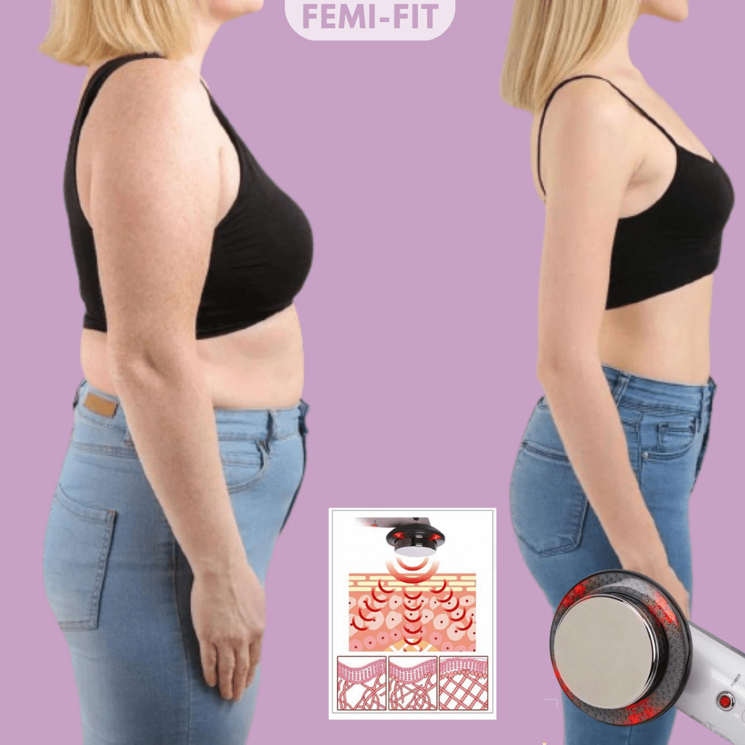 SLIMSHAPE – 3-in-1 Cellulite and Fat Burner with EMS, Ultrasound & Infrared
