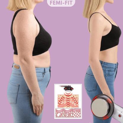 SLIMSHAPE – 3-in-1 Cellulite and Fat Burner with EMS, Ultrasound & Infrared